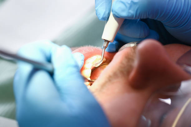 Best Cosmetic Emergency Dentistry in University, FL