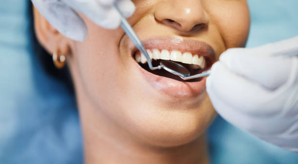 Best Emergency Treatment for Dental Infections or Abscesses in University, FL
