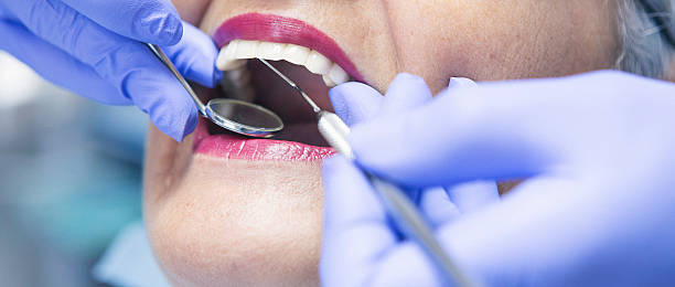 Best Emergency Tooth Extraction in University, FL